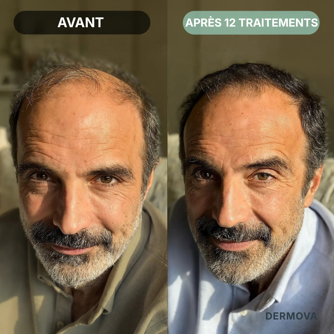 Kit de renouvellement capillaire