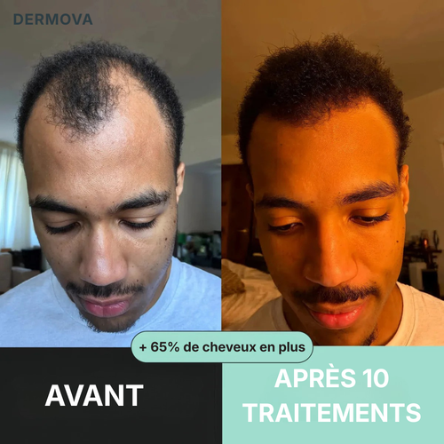 Protocole de Renouvellement Capillaire