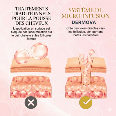 Protocole de Renouvellement Capillaire