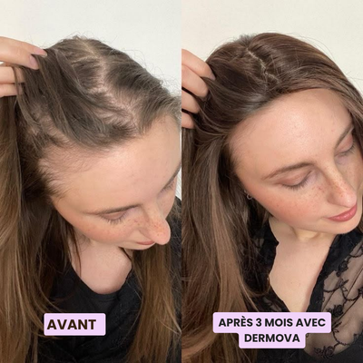 kit de renouvellement capillaire